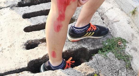 水泥蓋板破損造成人受傷